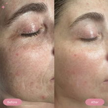 Load image into Gallery viewer, Led Light Mask For Face