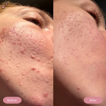 Load image into Gallery viewer, Led Light Mask For Face