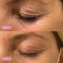 Load image into Gallery viewer, Led Light Mask For Face